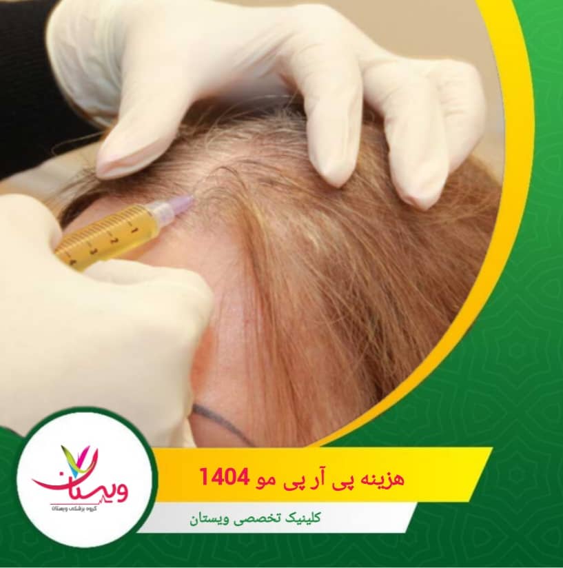 روش پی آر پی به دلیل استفاده از پلاسمای خون خود فرد، روشی ایمن و طبیعی محسوب میشود و اگرچه هزینه آن ممکن است نسبتاً بالا به نظر برسد، اما در مقایسه با کاشت مو یا درمانهای دارویی طولانیمدت، ماندگاری و اثربخشی بیشتری دارد. هزینه پی آر پی مو ۱۴۰۴