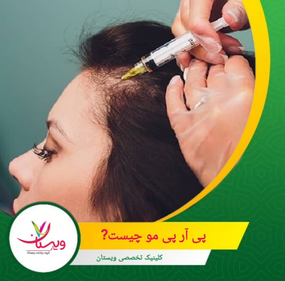 پی آر پی عوارض کمی دارد، دوران نقاهت کوتاهی دارد و چون از خون خود فرد استفاده میشود، احتمال حساسیت یا واکنش آلرژیک در آن تقریباً صفر است. پی آر پی مو چیست؟