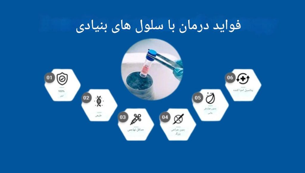 مزایای تزریق سلول بنیادی به زانو