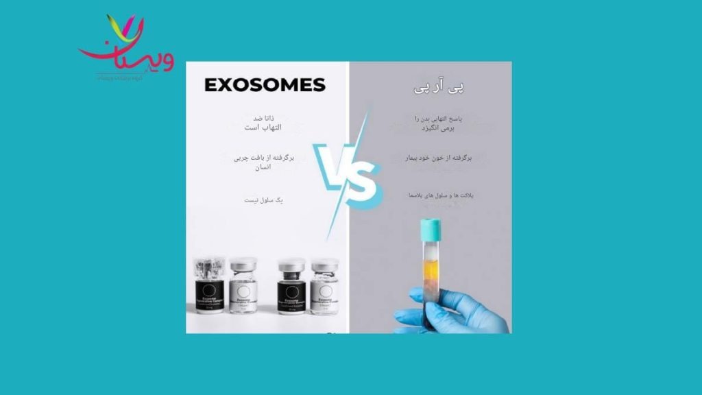 تفاوت اگزوزوم با پی آر پی
