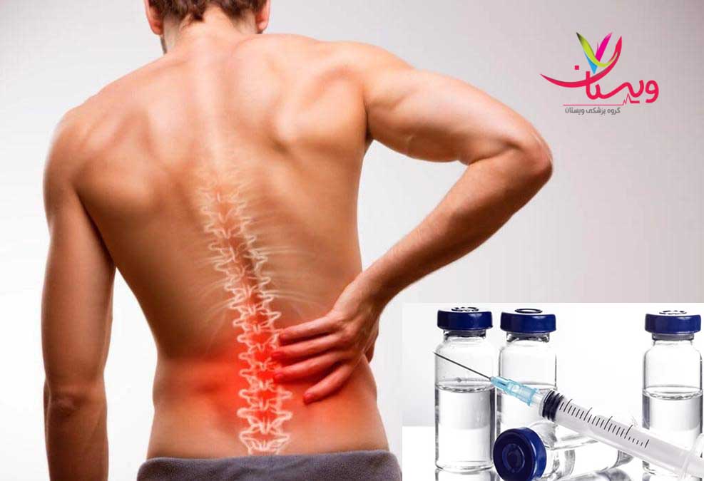 بهترین آمپول برای درد سیاتیک