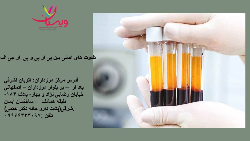 تفاوت prp و prgf از نظر بالینی