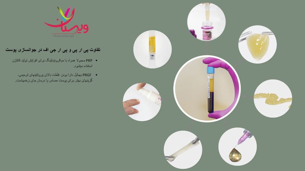 تاثیر prp و prgf در بازسازی پوست