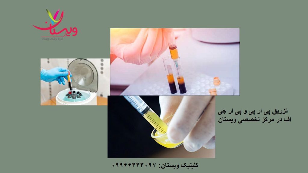 تفاوت prp و prgf